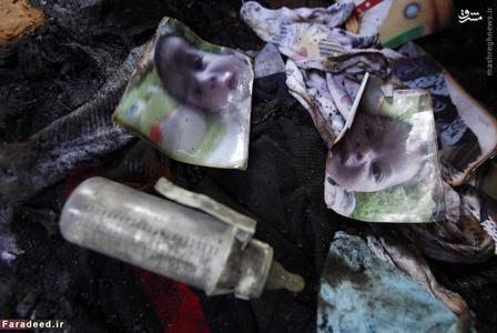 عکس/ سوختن نوزاد در حمله صهیونیست‌ها 