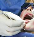 150 هزار دانش‌آموز زیر پوشش طرح سلامت دهان و دندان قرار گرفتند